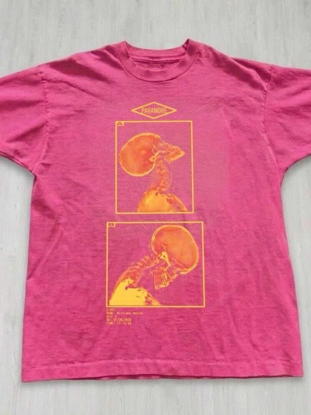 Gildan Pink Tee with Yellow-Orange Skull X-Ray Graphic